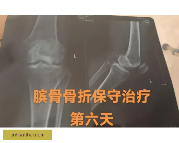 穆迪受伤可能影响下赛季复出队医称髌骨肌腱问题严重